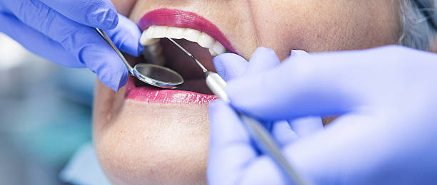 Best Emergency Dental Care for Trauma or Injury in University Of Lifornia Davis, CA